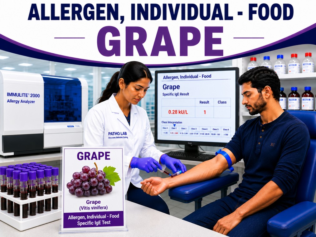 Grape allergy test showing specific IgE antibody analysis for grape sensitization, fruit allergy diagnosis, and food allergy evaluation