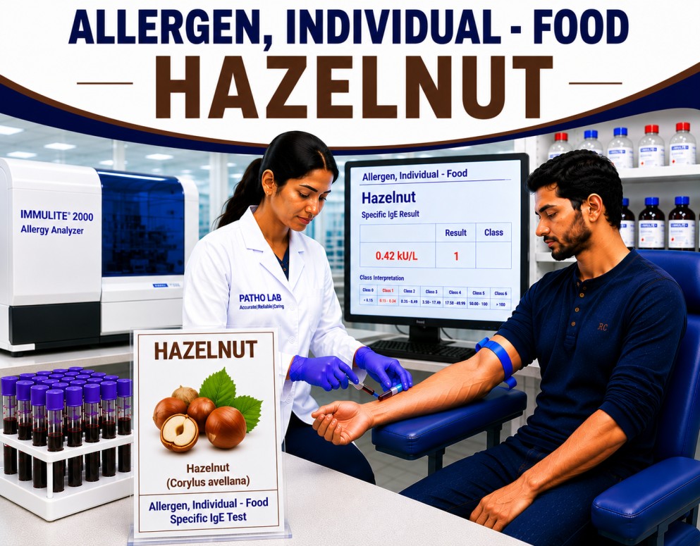 Hazelnut allergy test showing specific IgE antibody analysis for hazelnut sensitization, tree nut allergy diagnosis, and food allergy evaluation