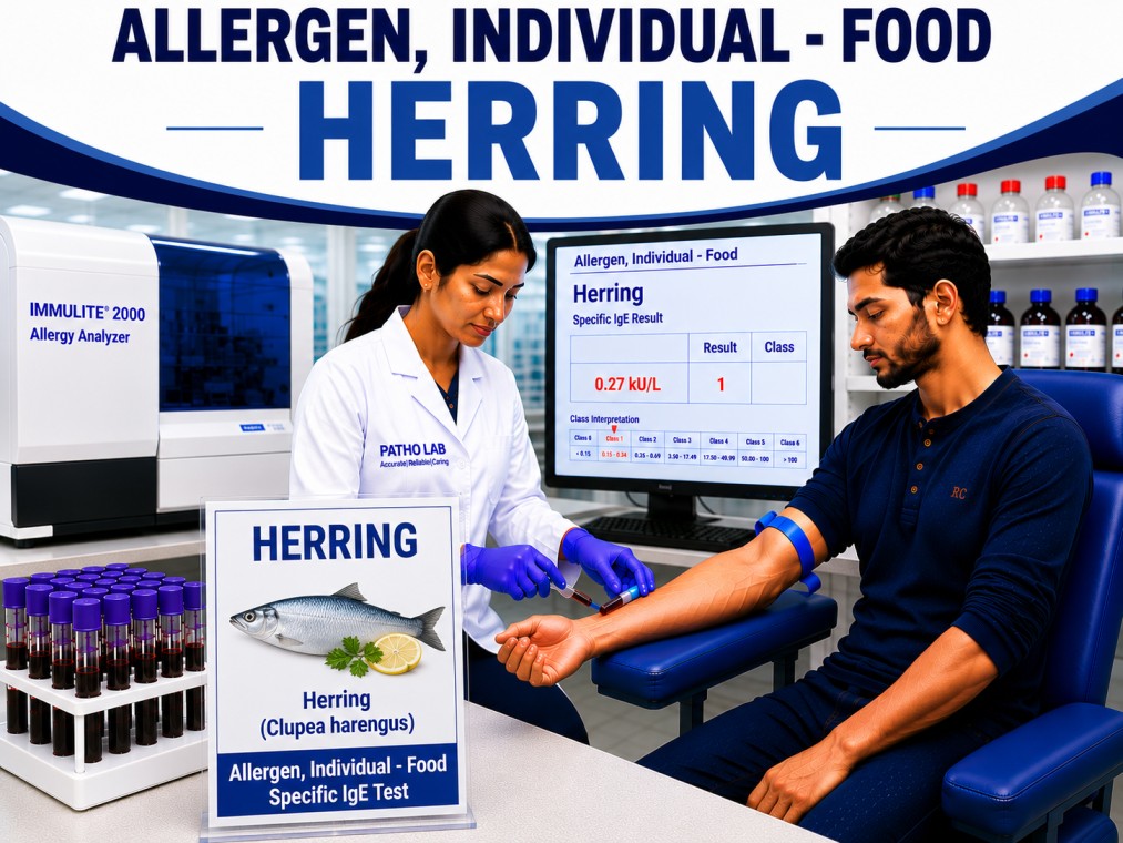 Herring fish allergy test showing specific IgE antibody analysis for herring sensitization, fish allergy diagnosis, and seafood allergy evaluation