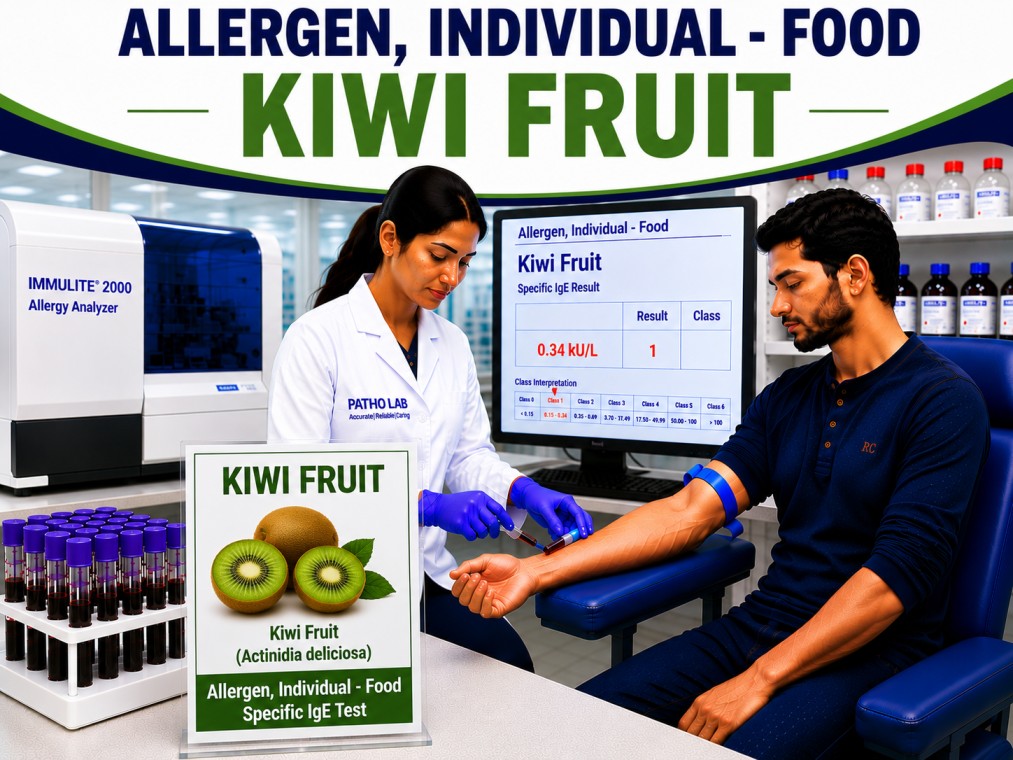 Kiwi fruit allergy test showing specific IgE antibody analysis for kiwi sensitization, fruit allergy diagnosis, and food allergy evaluation