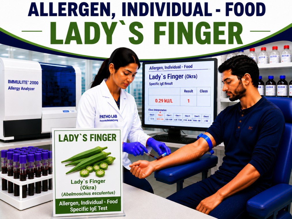Lady’s Finger okra allergy test showing specific IgE antibody analysis for okra sensitization, vegetable allergy diagnosis, and food allergy evaluation