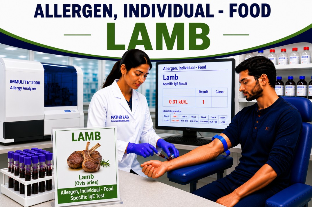 Lamb meat allergy test showing specific IgE antibody analysis for lamb sensitization, meat allergy diagnosis, and food allergy evaluation
