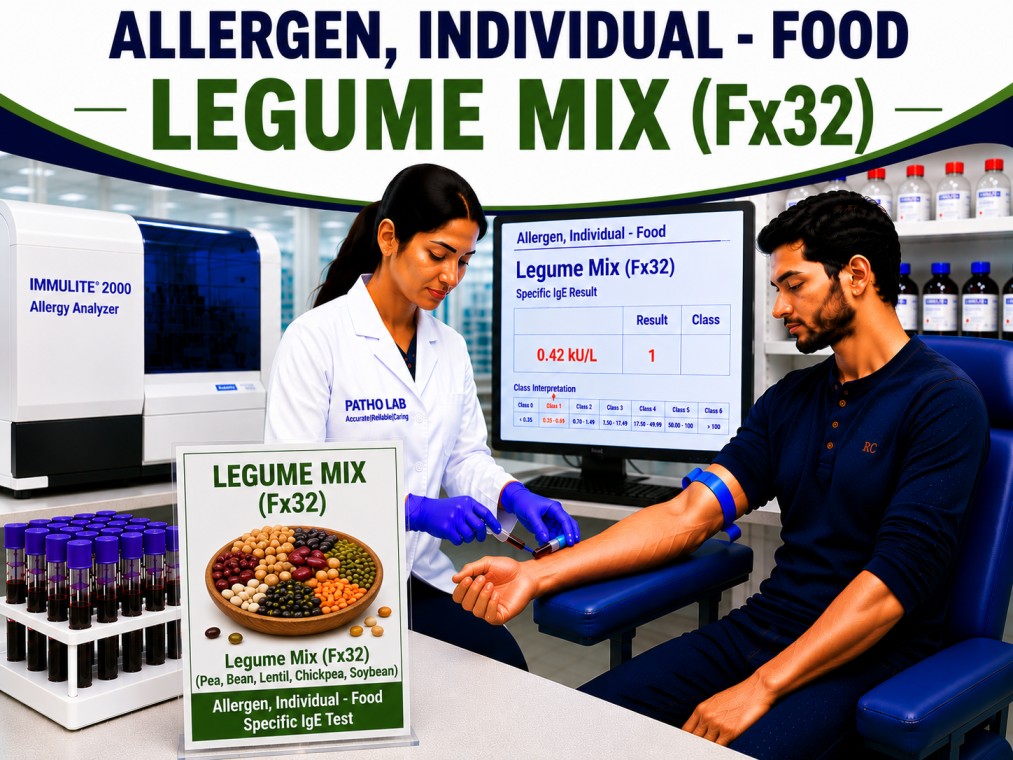 Legume Mix Fx32 allergy test showing specific IgE antibody analysis for multiple legume allergens, food allergy diagnosis, and allergy screening