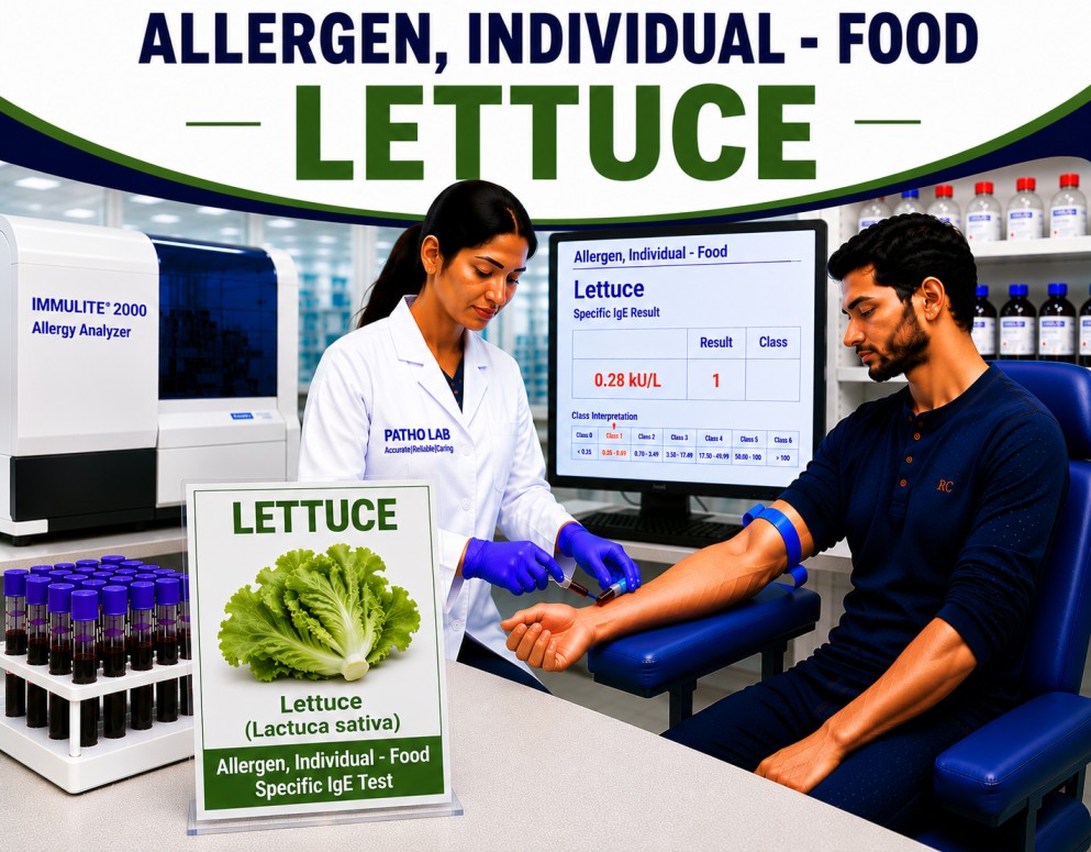 Lettuce allergy test showing specific IgE antibody analysis for lettuce sensitization, vegetable allergy diagnosis, and food allergy evaluation