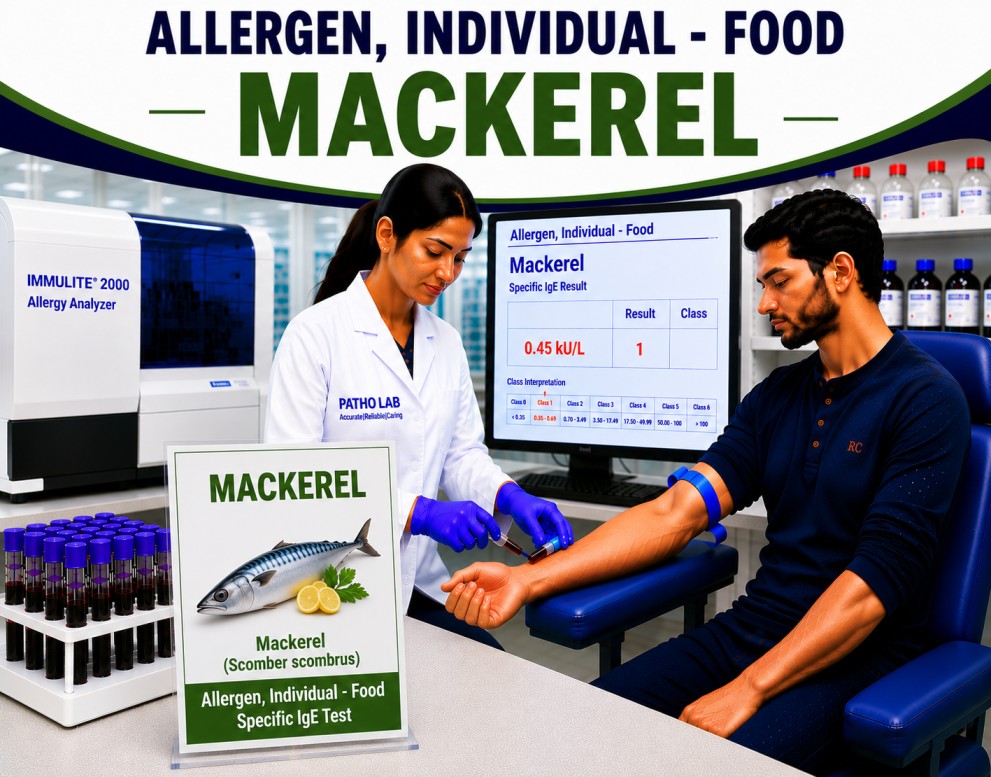 Mackerel fish allergy test showing specific IgE antibody analysis for mackerel sensitization, fish allergy diagnosis, and seafood allergy evaluation