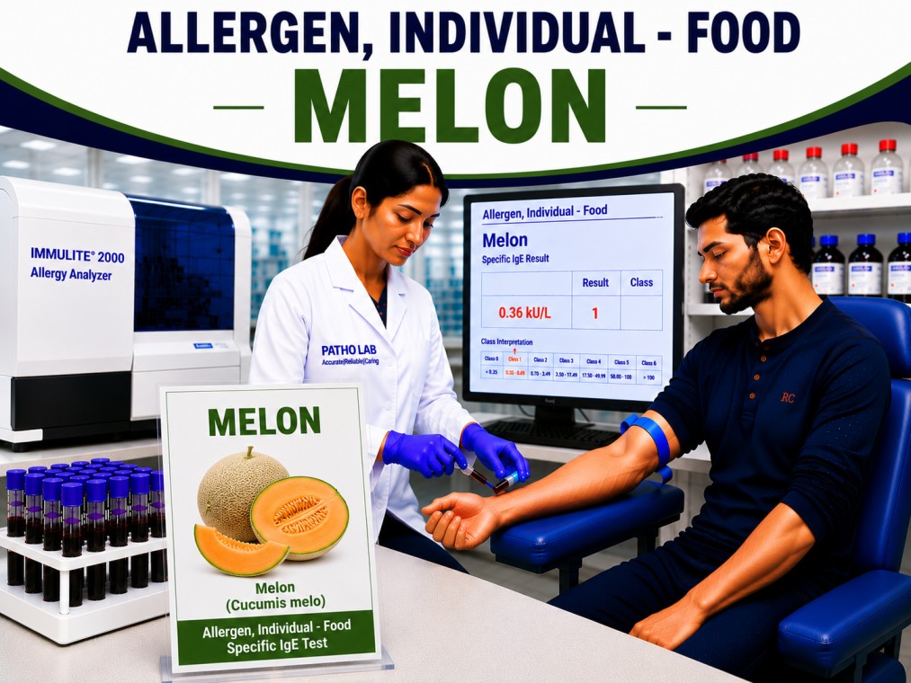 Melon allergy test showing specific IgE antibody analysis for melon sensitization, fruit allergy diagnosis, and food allergy evaluation