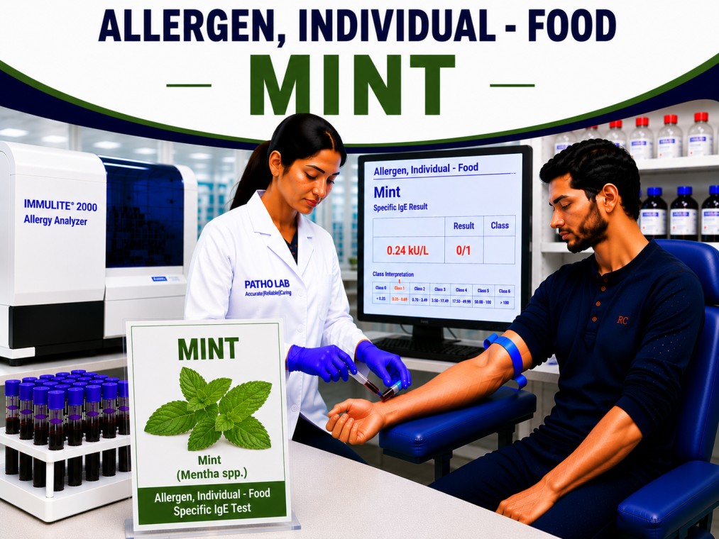 Mint allergy test showing specific IgE antibody analysis for mint sensitization, herb allergy diagnosis, and food allergy evaluation