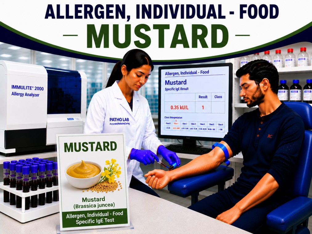 Mustard allergy test showing specific IgE antibody analysis for mustard sensitization, spice allergy diagnosis, and food allergy evaluation