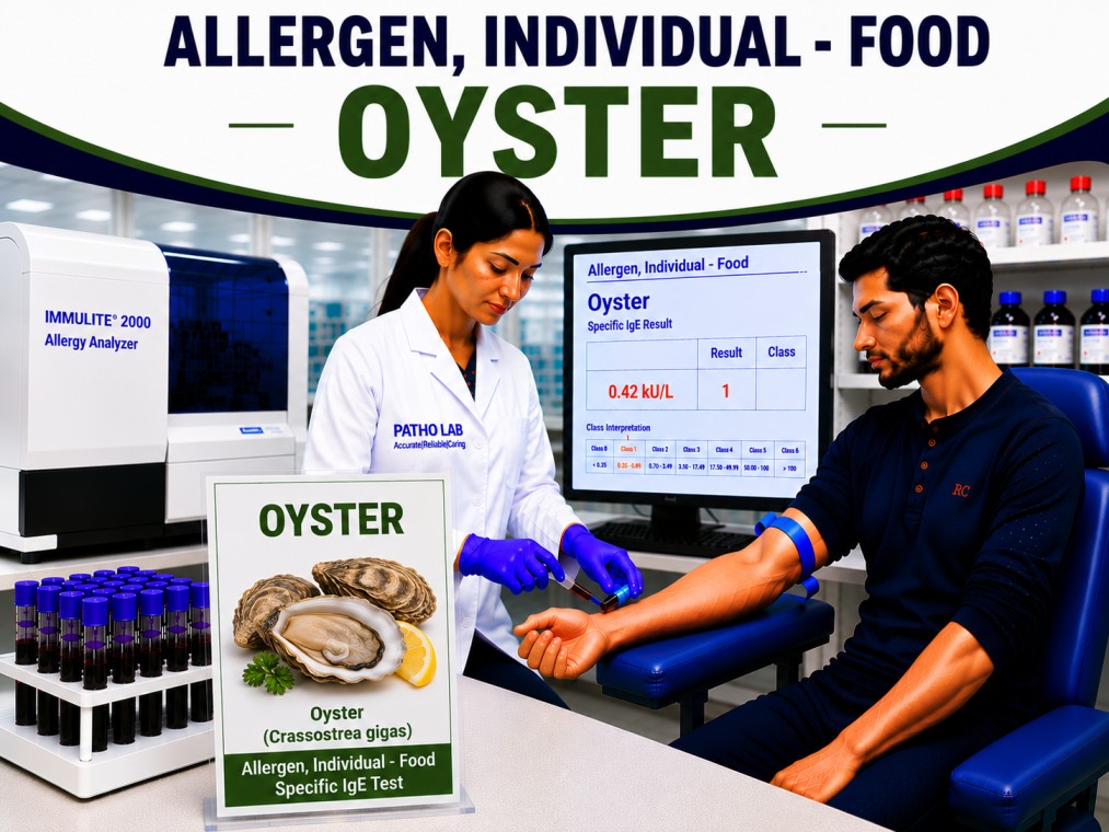 Oyster allergy test showing specific IgE antibody analysis for oyster sensitization, shellfish allergy diagnosis, and seafood allergy evaluation