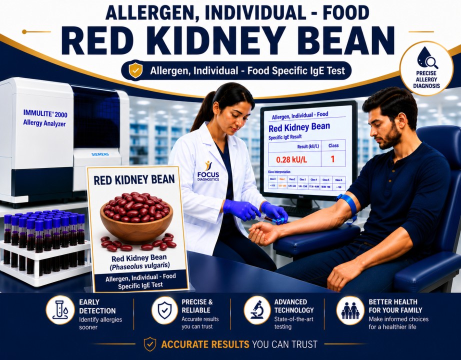 Red kidney bean allergy test showing specific IgE antibody analysis for kidney bean sensitization, legume allergy diagnosis, and food allergy evaluation