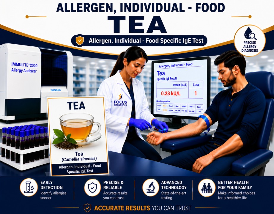 Tea allergy test showing specific IgE antibody analysis for tea sensitization, beverage allergy diagnosis, and food allergy evaluation
