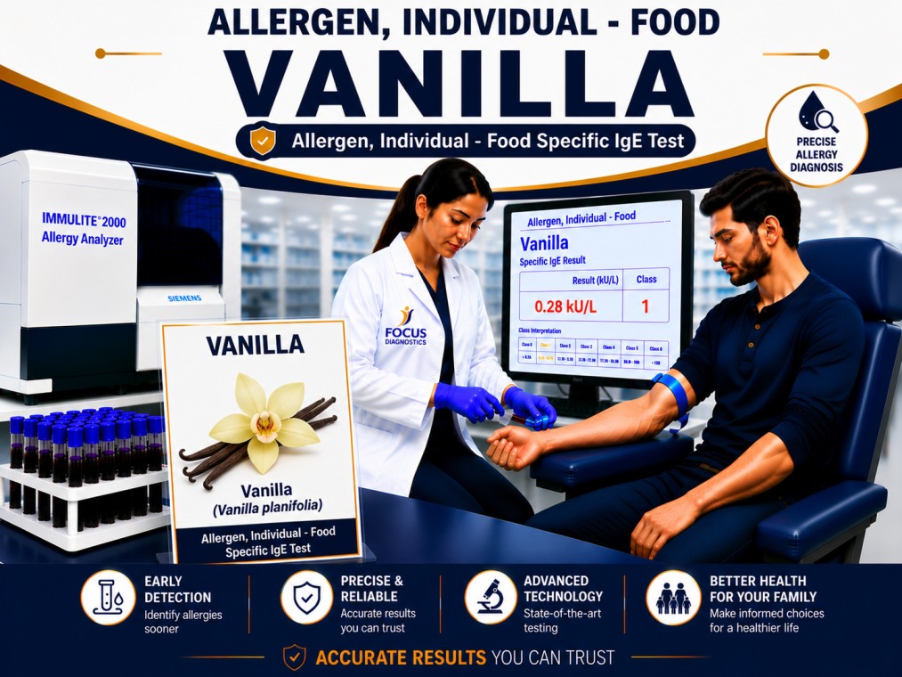 Vanilla allergy test showing specific IgE antibody analysis for vanilla sensitization, flavoring allergy diagnosis, and food allergy evaluation