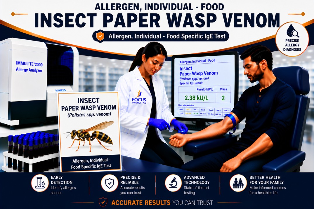 Paper wasp venom allergy test showing specific IgE antibody analysis for wasp sting sensitization, venom allergy diagnosis, and anaphylaxis risk assessment