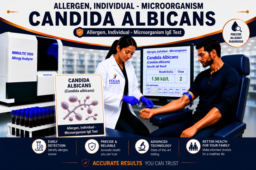 Candida albicans allergy test showing specific IgE antibody analysis for fungal allergen sensitization, respiratory allergy diagnosis, and hypersensitivity evaluation