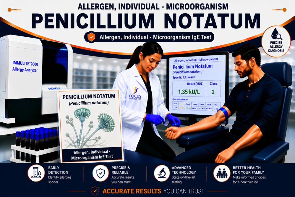 Penicillium notatum mold allergy test showing specific IgE antibody analysis for fungal allergen sensitization, mold allergy diagnosis, and respiratory allergy evaluation