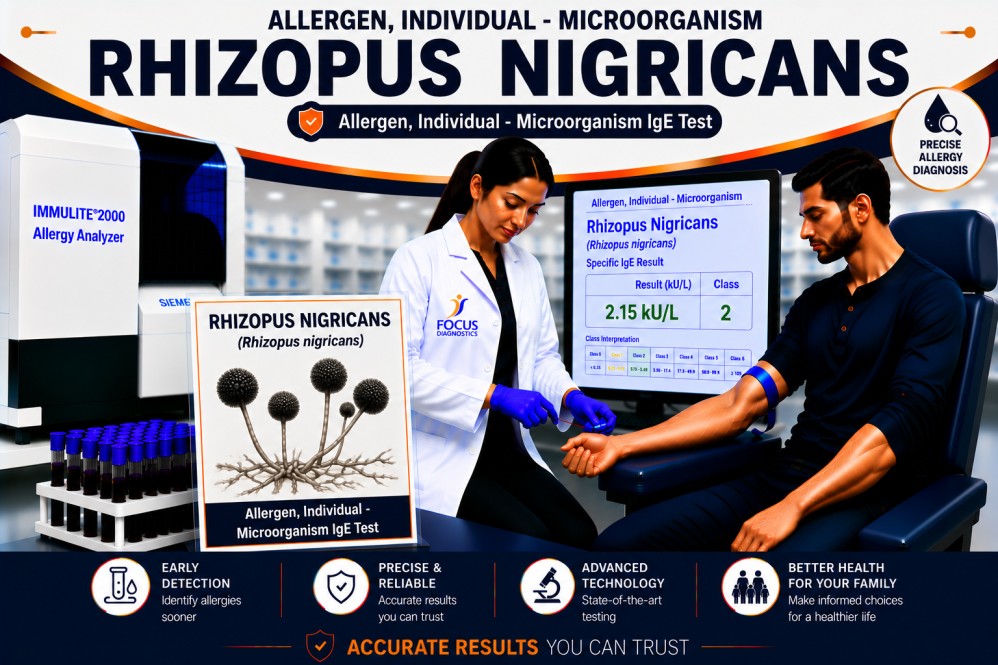 Rhizopus nigricans mold allergy test showing specific IgE antibody analysis for fungal allergen sensitization, mold allergy diagnosis, and respiratory allergy evaluation