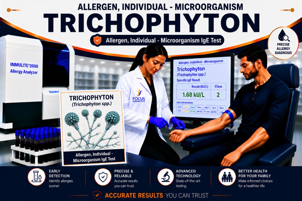 Trichophyton allergy test showing specific IgE antibody analysis for fungal allergen sensitization, respiratory allergy diagnosis, and hypersensitivity evaluation