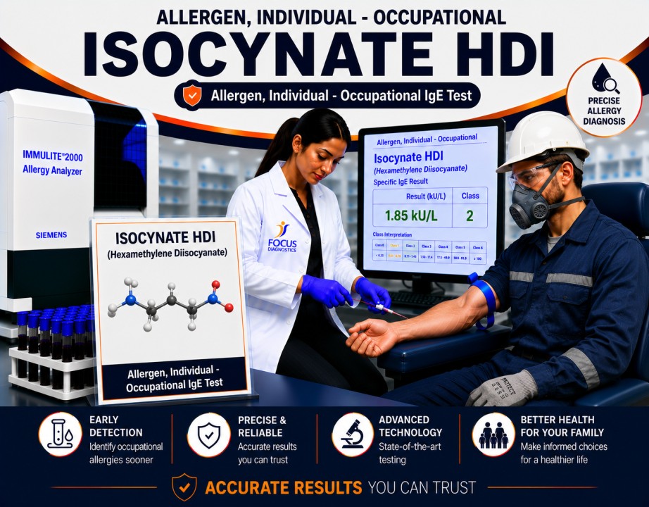 Toluene Diisocyanate (TDI) allergy test showing specific IgE antibody analysis for occupational sensitization, workplace allergy diagnosis, and occupational asthma evaluation