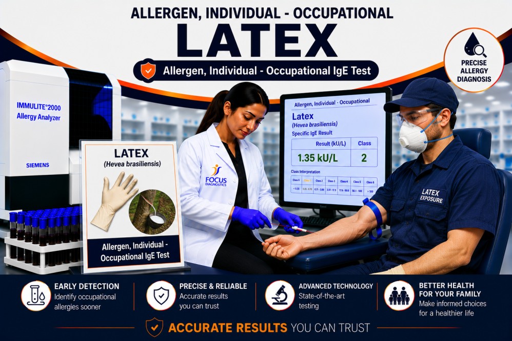 Natural rubber latex allergy test showing specific IgE antibody analysis for occupational latex sensitization, contact allergy diagnosis, and latex-induced respiratory reactions