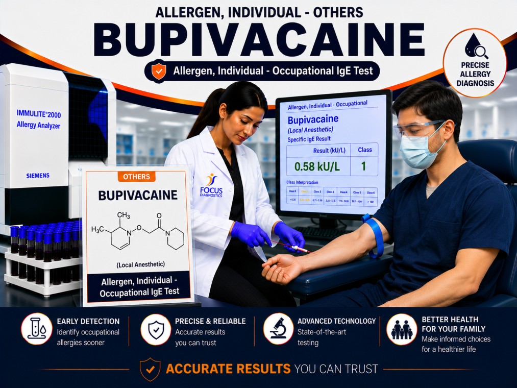 Bupivacaine allergy test showing specific IgE antibody analysis for local anesthetic hypersensitivity, drug allergy diagnosis, and anesthesia safety evaluation