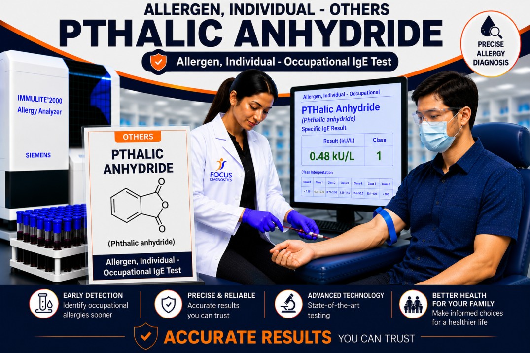 Phthalic anhydride allergy test showing specific IgE antibody analysis for occupational chemical sensitization, workplace allergy diagnosis, and occupational asthma evaluation