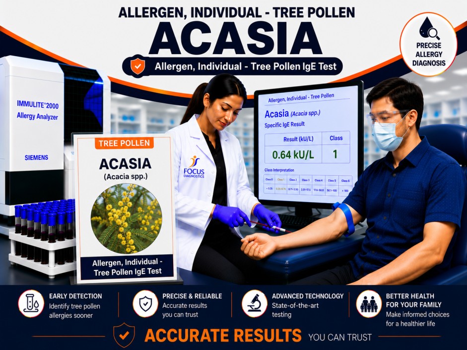 Acacia tree pollen allergy test showing specific IgE antibody analysis for tree pollen sensitization, hay fever diagnosis, and respiratory allergy evaluation