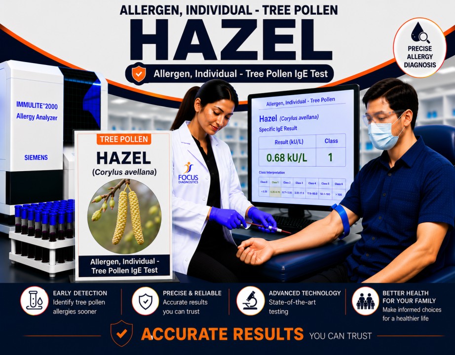 Hazel tree pollen allergy test showing specific IgE antibody analysis for hazel pollen sensitization, hay fever diagnosis, and respiratory allergy evaluation