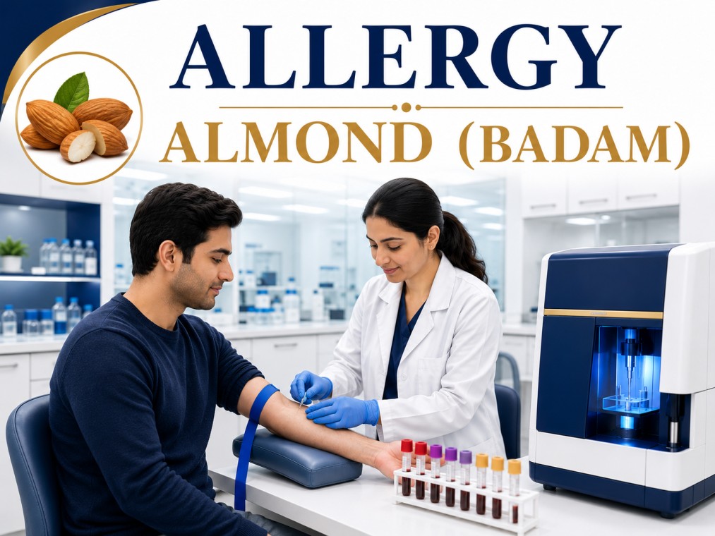 Almond (Badam) allergy blood test showing specific IgE antibody analysis for tree nut allergy, food hypersensitivity, and allergic reactions