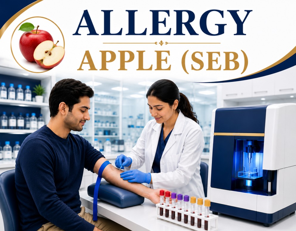 Apple (Seb) allergy blood test showing specific IgE antibody analysis for fruit allergy, oral allergy syndrome, and food hypersensitivity reactions