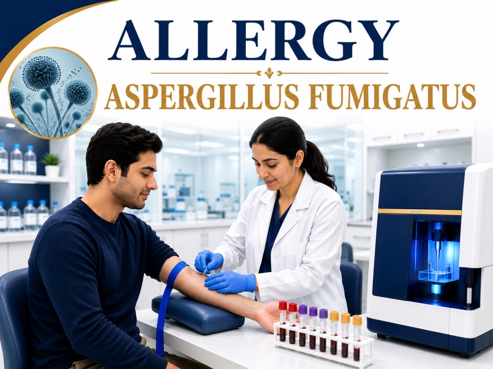 Aspergillus fumigatus allergy blood test showing specific IgE antibody analysis for mold allergy, respiratory hypersensitivity, allergic rhinitis, and asthma evaluation