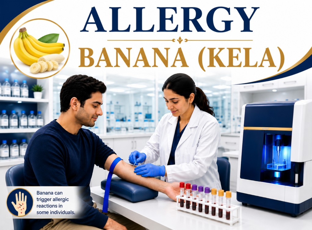 Banana (Kela) allergy blood test showing specific IgE antibody analysis for fruit allergy, oral allergy syndrome, latex-fruit syndrome, and food hypersensitivity reactions