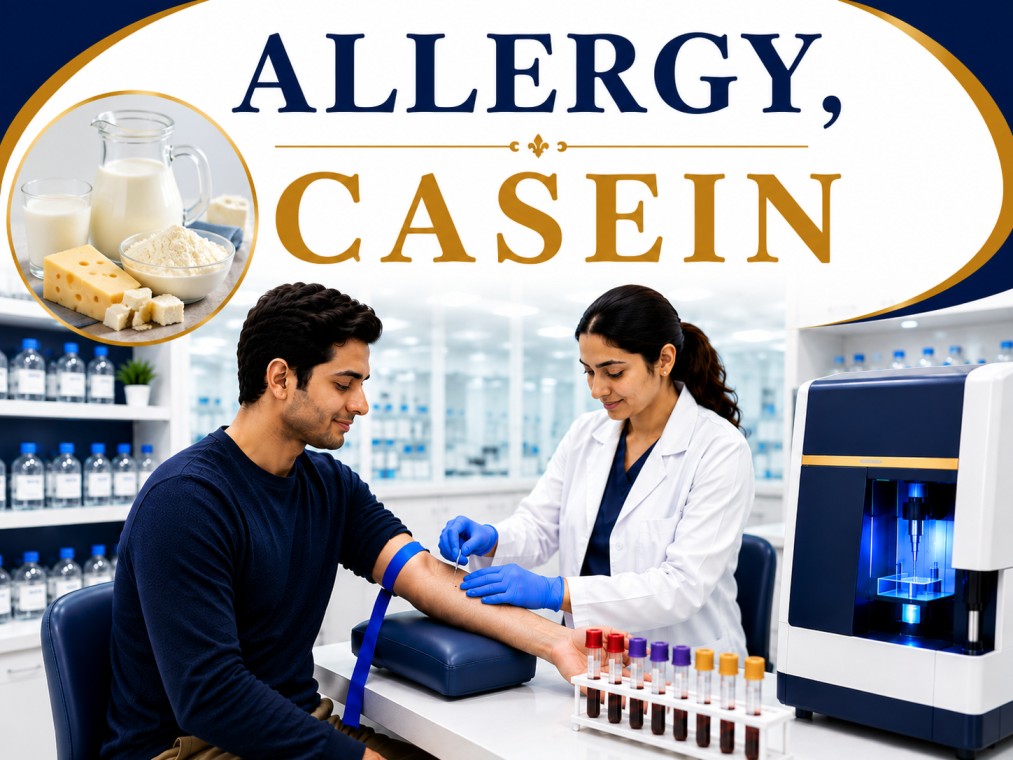 Casein allergy blood test showing specific IgE antibody analysis for milk protein allergy, dairy hypersensitivity, and food allergy evaluation