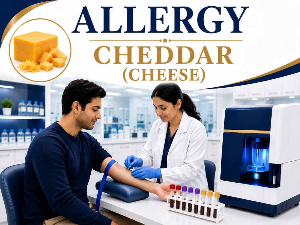 Cheddar cheese allergy blood test showing specific IgE antibody analysis for dairy allergy, milk protein hypersensitivity, and food allergy evaluation