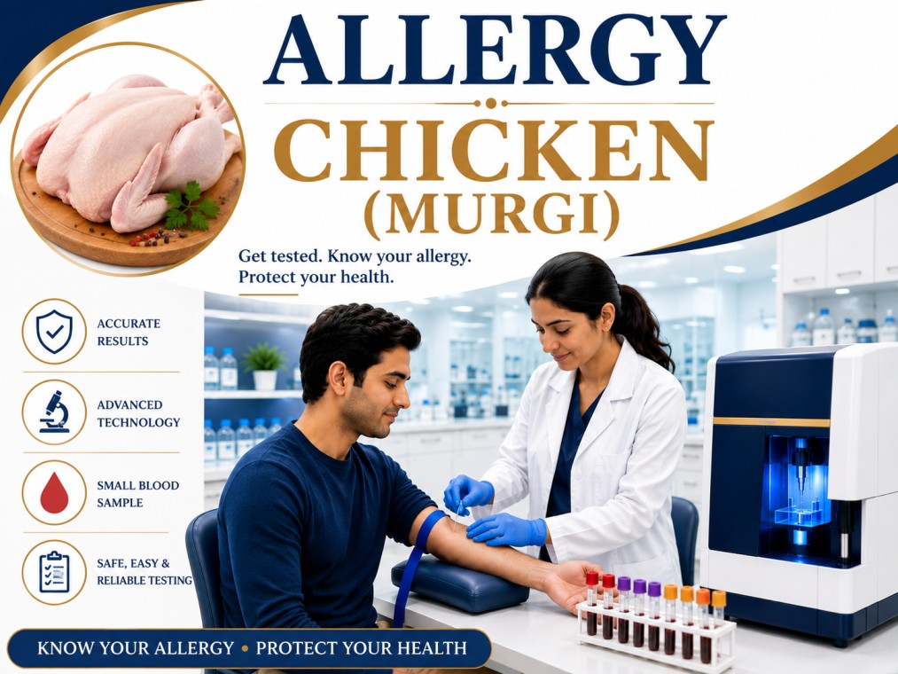 Chicken (Murgi) allergy blood test showing specific IgE antibody analysis for poultry allergy, food hypersensitivity, and allergic reaction evaluation