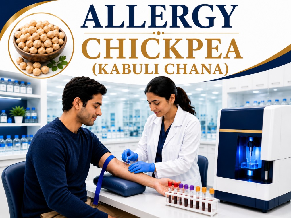 Chickpea (Kabuli Chana) allergy blood test showing specific IgE antibody analysis for legume allergy, food hypersensitivity, and allergic reaction evaluation