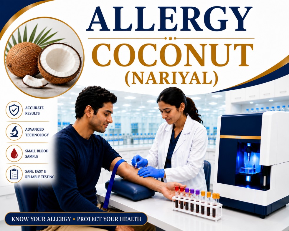 Coconut (Nariyal) allergy blood test showing specific IgE antibody analysis for food allergy, hypersensitivity, and allergic reaction evaluation