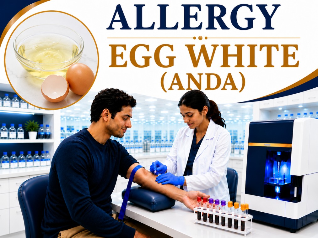 Egg white (Anda) allergy blood test showing specific IgE antibody analysis for egg protein allergy, food hypersensitivity, and allergic reaction evaluation