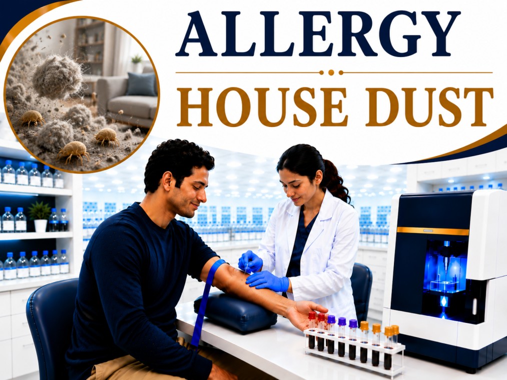 House dust allergy blood test showing specific IgE antibody analysis for indoor environmental allergy, allergic rhinitis, asthma, and respiratory hypersensitivity evaluation