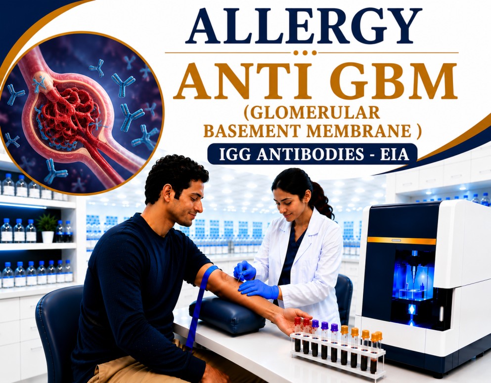 Anti-GBM (Glomerular Basement Membrane) IgG antibodies blood test by EIA for diagnosing Goodpasture syndrome, autoimmune kidney disease, and pulmonary-renal syndrome