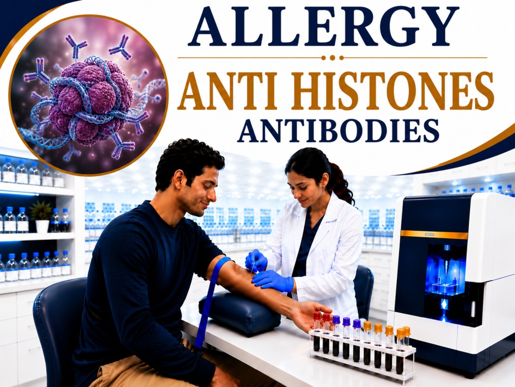 Anti-Histone antibodies blood test for diagnosing Drug-Induced Lupus, Systemic Lupus Erythematosus, and autoimmune connective tissue disorders