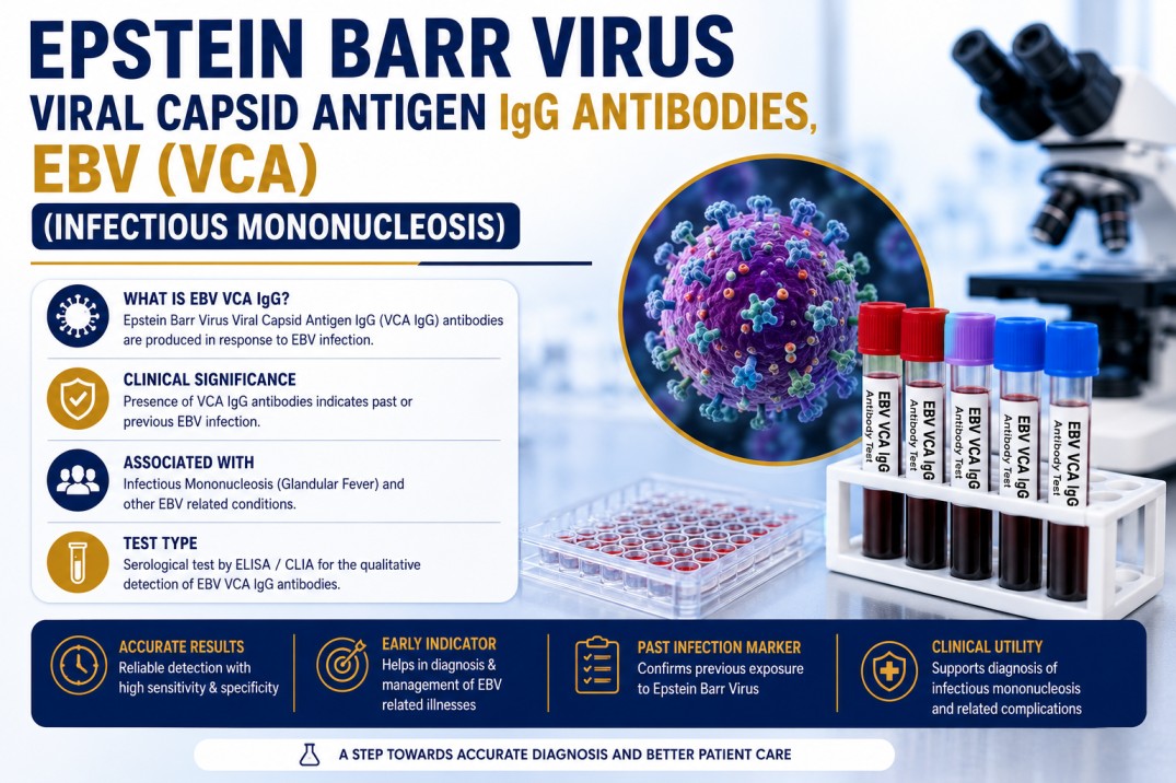 Epstein-Barr Virus Viral Capsid Antigen (VCA) IgG Antibodies blood test for detecting previous EBV infection and supporting infectious mononucleosis diagnosis.