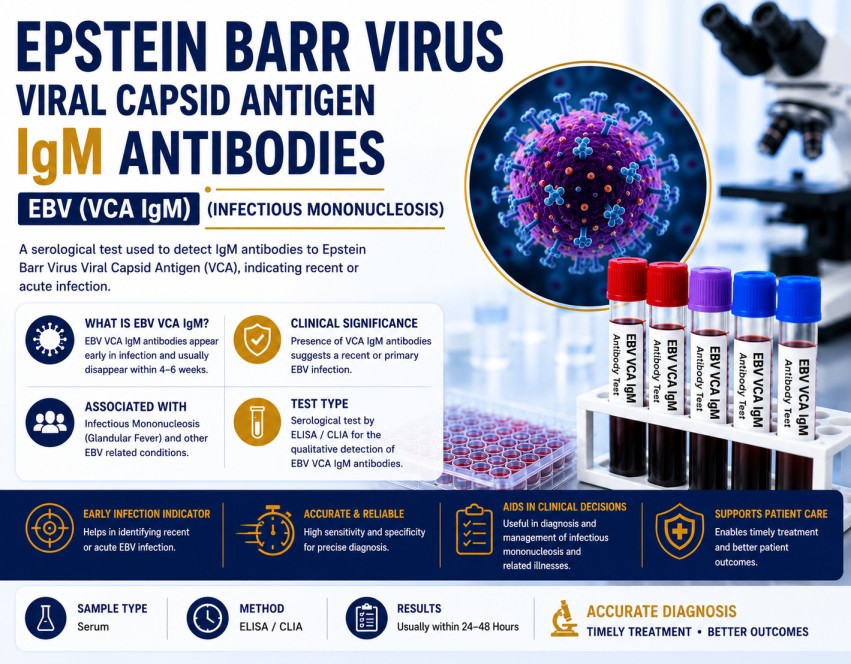 Epstein-Barr Virus Viral Capsid Antigen (VCA) IgM Antibodies blood test for diagnosing recent EBV infection and infectious mononucleosis using a serum sample.