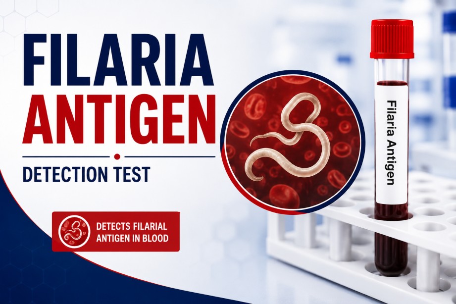 Filaria Antigen blood test for diagnosing active lymphatic filariasis by detecting circulating filarial antigens in a serum sample.