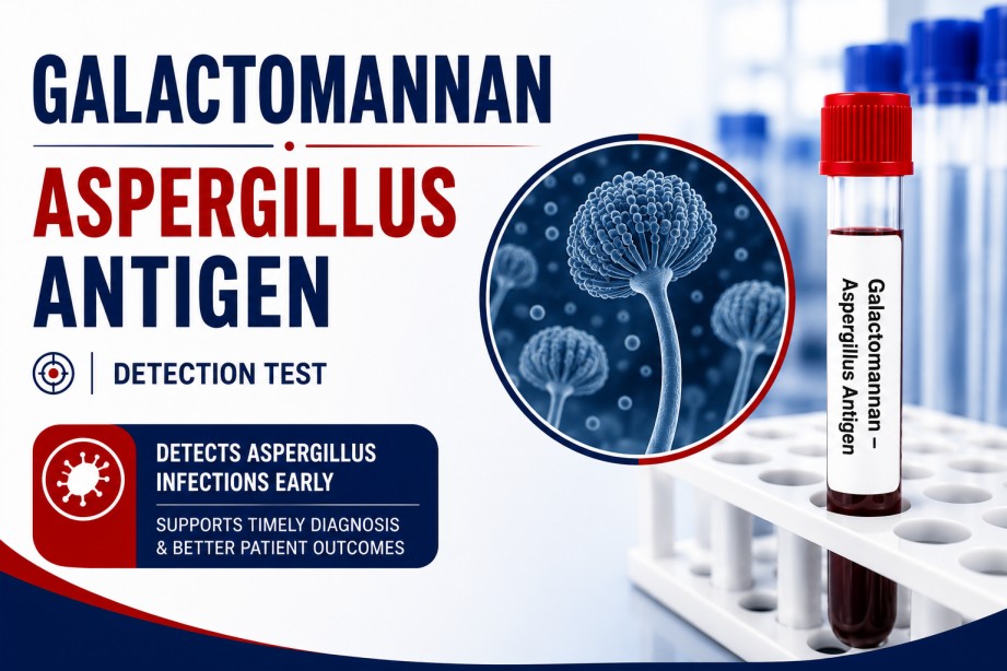 Galactomannan Aspergillus Antigen blood test for early detection of invasive aspergillosis in immunocompromised patients using a serum sample.