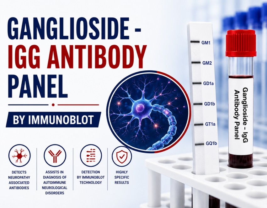 Ganglioside IgG Antibody Panel by Immunoblot blood test for diagnosing autoimmune neuropathies including Guillain-Barré Syndrome and Multifocal Motor Neuropathy.