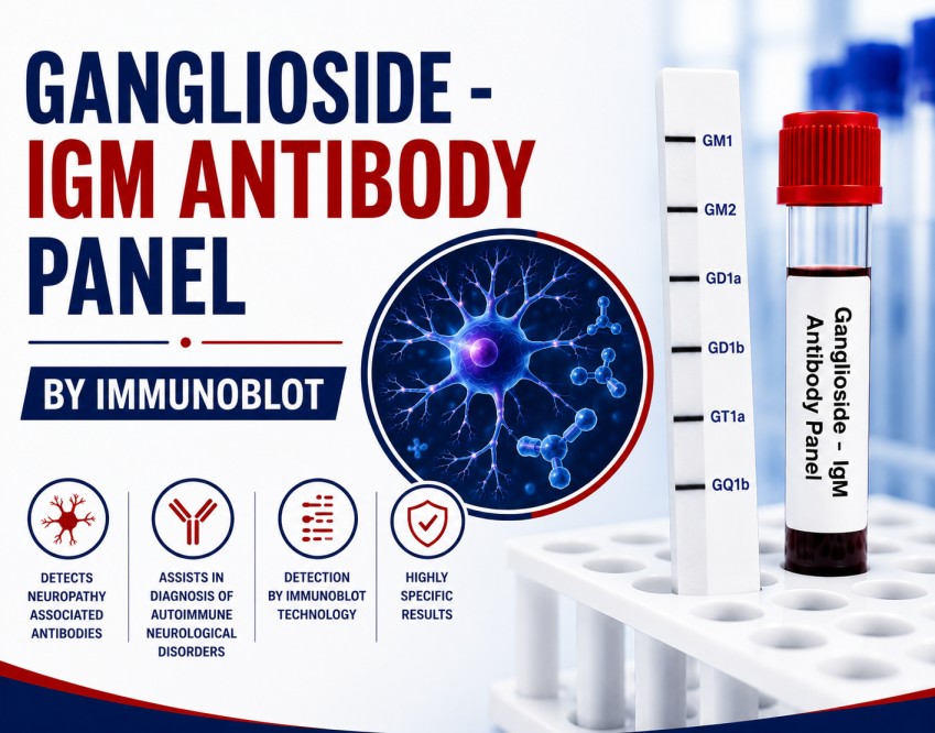 Ganglioside IgM Antibody Panel by Immunoblot blood test for diagnosing autoimmune peripheral neuropathies, including Multifocal Motor Neuropathy.