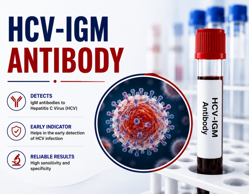 HCV IgM Antibody blood test for evaluating Hepatitis C virus infection using a serum sample in a diagnostic laboratory.