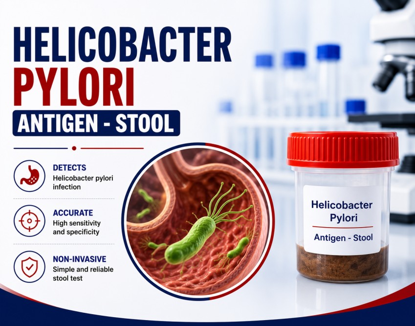 Helicobacter pylori (H. pylori) Stool Antigen Test for detecting active H. pylori infection associated with gastritis and peptic ulcer disease.
