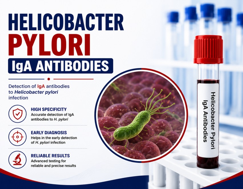 Helicobacter pylori IgA Antibodies blood test for evaluating H. pylori infection associated with gastritis and peptic ulcer disease using a serum sample.
