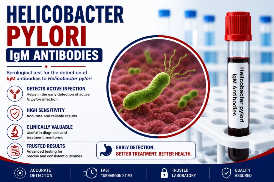 Helicobacter pylori IgM Antibodies blood test for evaluating immune response to H. pylori infection using a serum sample in a diagnostic laboratory.
